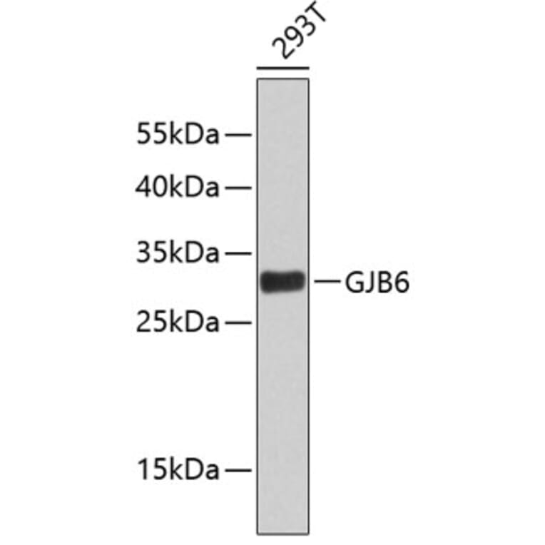 Western Blot - Anti-GJB6 Antibody (A2906) - Antibodies.com