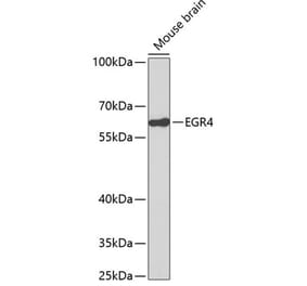Western Blot - Anti-EGR4 Antibody (A14249) - Antibodies.com