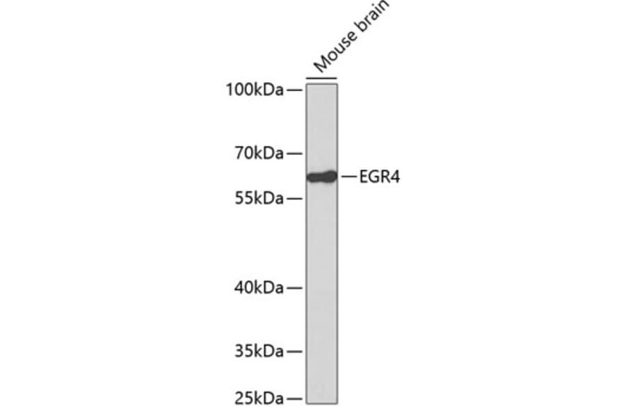 Western Blot - Anti-EGR4 Antibody (A14249) - Antibodies.com