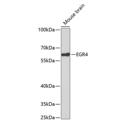 Western Blot - Anti-EGR4 Antibody (A14249) - Antibodies.com