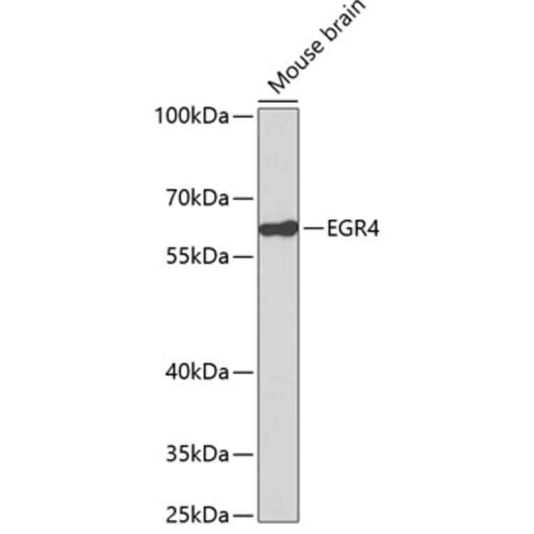 Western Blot - Anti-EGR4 Antibody (A14249) - Antibodies.com