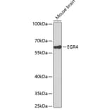 Western Blot - Anti-EGR4 Antibody (A14249) - Antibodies.com
