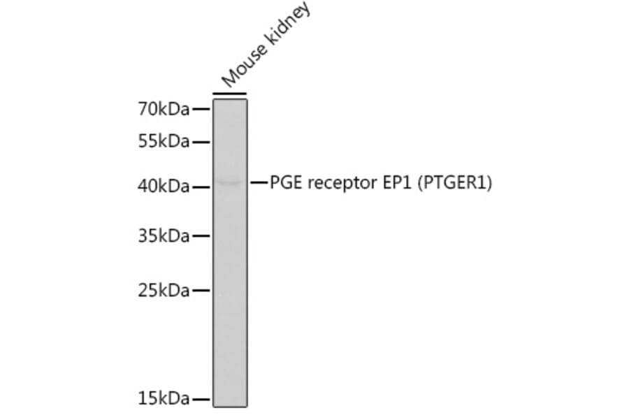 Western Blot - Anti-Prostaglandin E Receptor EP1/PTGER1 Antibody (A14250) - Antibodies.com