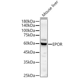 Western Blot - Anti-EPO-R Antibody (A14252) - Antibodies.com