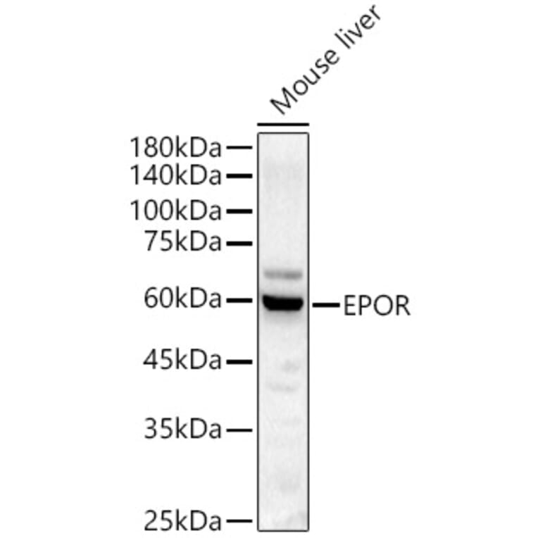 Western Blot - Anti-EPO-R Antibody (A14252) - Antibodies.com