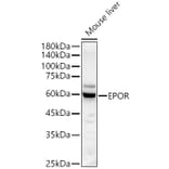 Western Blot - Anti-EPO-R Antibody (A14252) - Antibodies.com