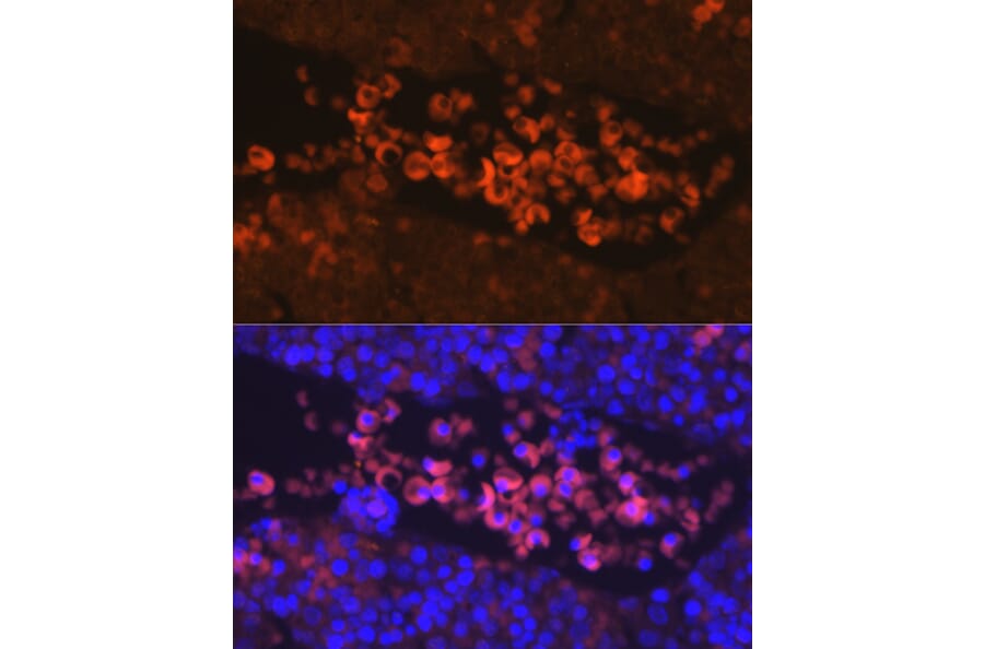 Immunofluorescence - Anti-EPO-R Antibody (A14252) - Antibodies.com