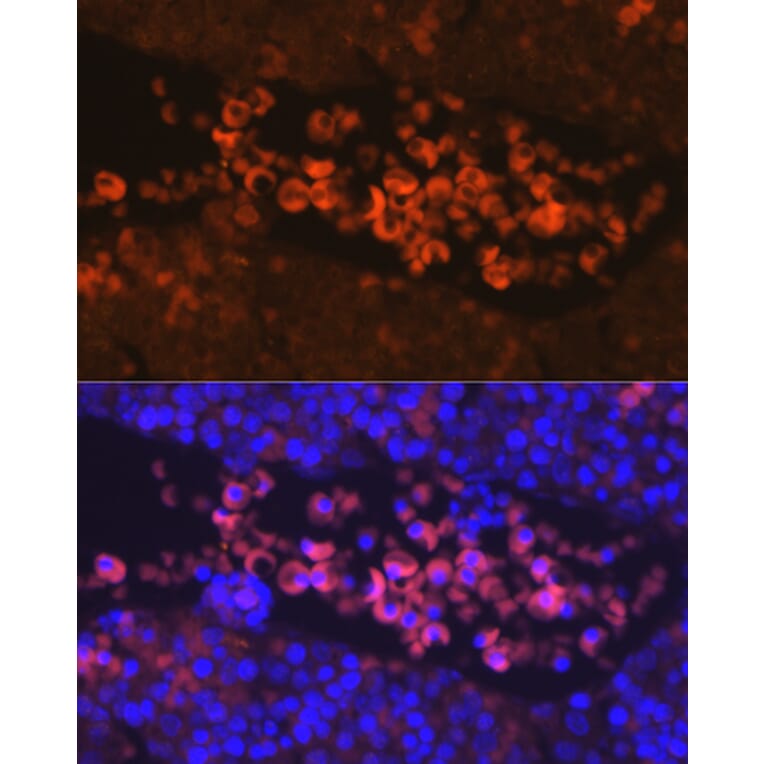 Immunofluorescence - Anti-EPO-R Antibody (A14252) - Antibodies.com