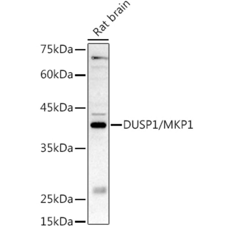 Western Blot - Anti-MKP-1 Antibody (A14253) - Antibodies.com