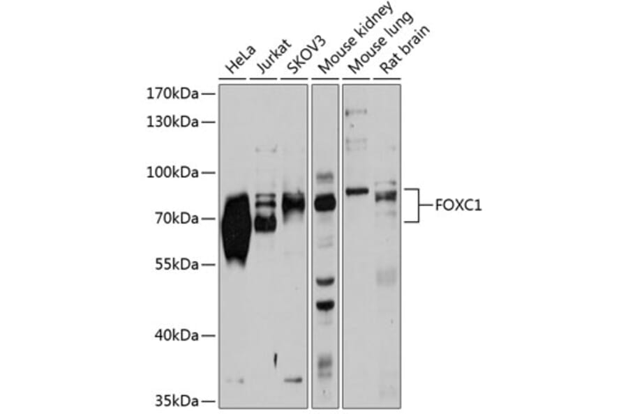 Western Blot - Anti-FOXC1 Antibody (A14255) - Antibodies.com