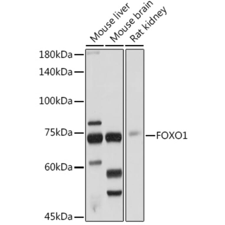 Western Blot - Anti-FOXO1A Antibody (A14259) - Antibodies.com