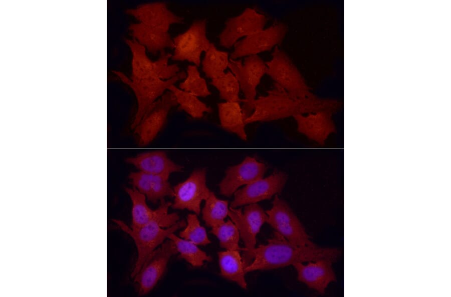 Immunofluorescence - Anti-FOXO1A Antibody (A14259) - Antibodies.com