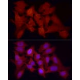 Immunofluorescence - Anti-FOXO1A Antibody (A14259) - Antibodies.com