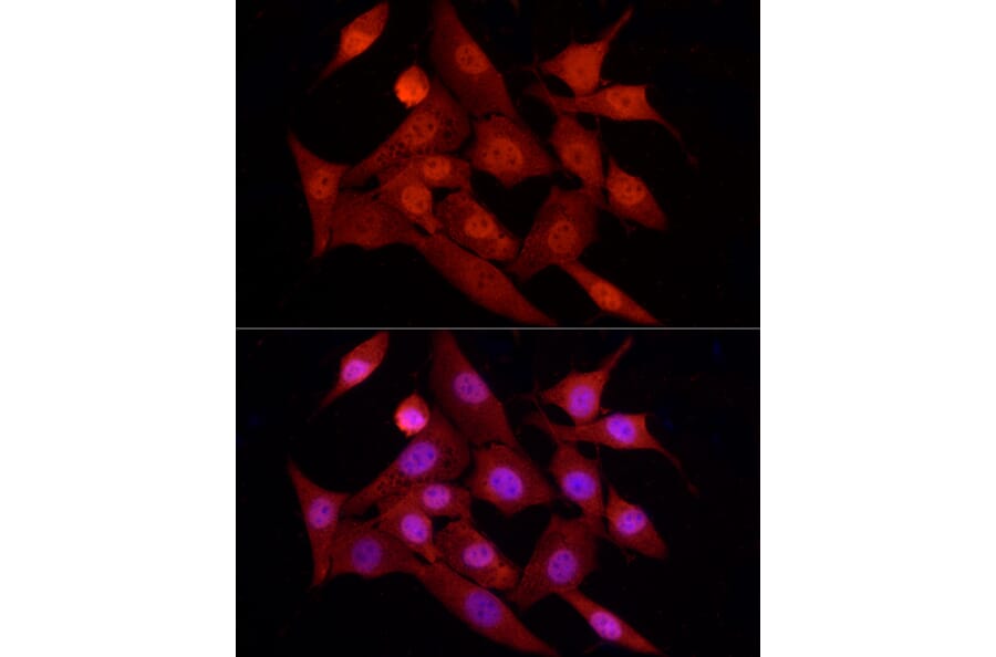 Immunofluorescence - Anti-FOXO1A Antibody (A14259) - Antibodies.com