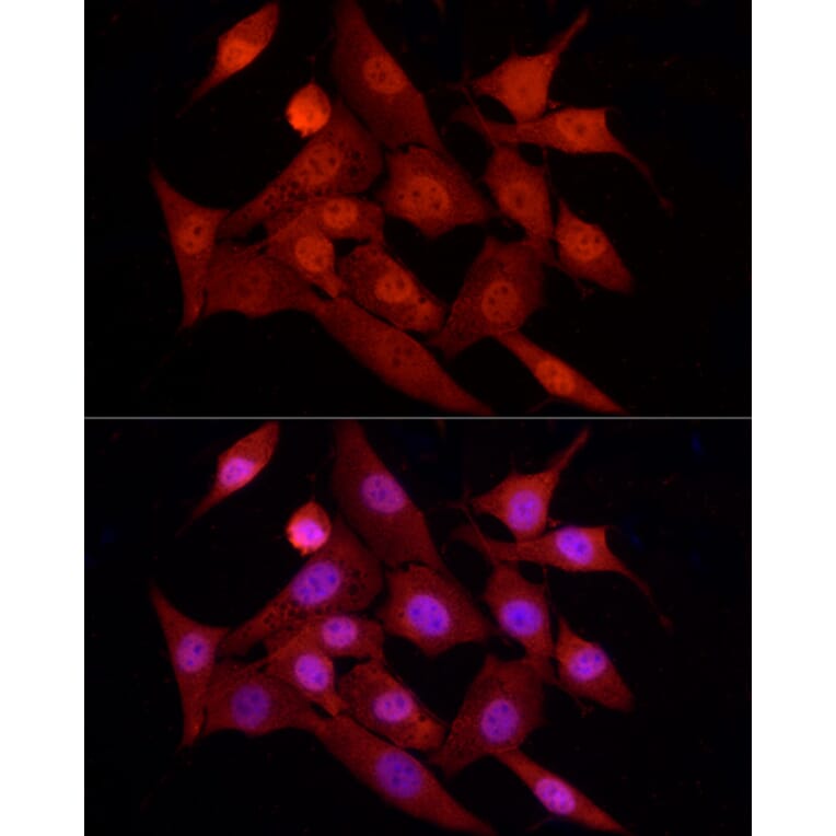 Immunofluorescence - Anti-FOXO1A Antibody (A14259) - Antibodies.com