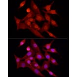 Immunofluorescence - Anti-FOXO1A Antibody (A14259) - Antibodies.com