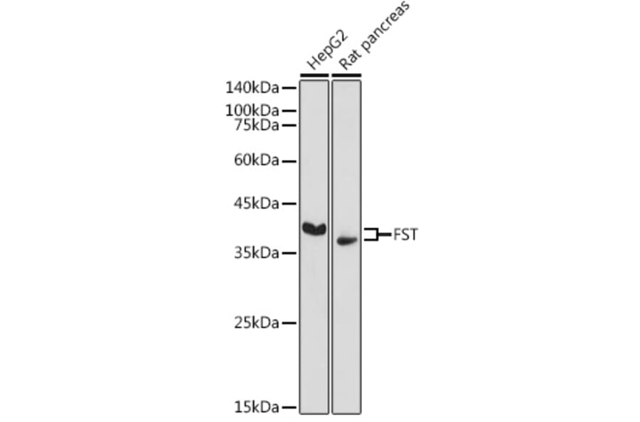 Western Blot - Anti-Follistatin Antibody (A14260) - Antibodies.com