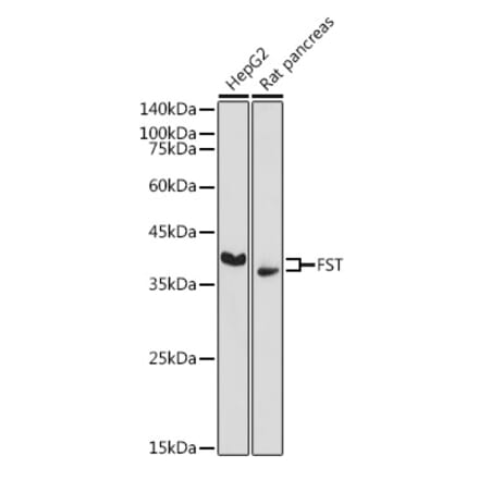 Western Blot - Anti-Follistatin Antibody (A14260) - Antibodies.com