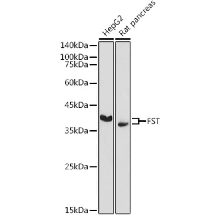 Western Blot - Anti-Follistatin Antibody (A14260) - Antibodies.com