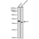 Western Blot - Anti-Follistatin Antibody (A14260) - Antibodies.com