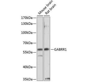 Western Blot - Anti-GABRR1 Antibody (A14261) - Antibodies.com