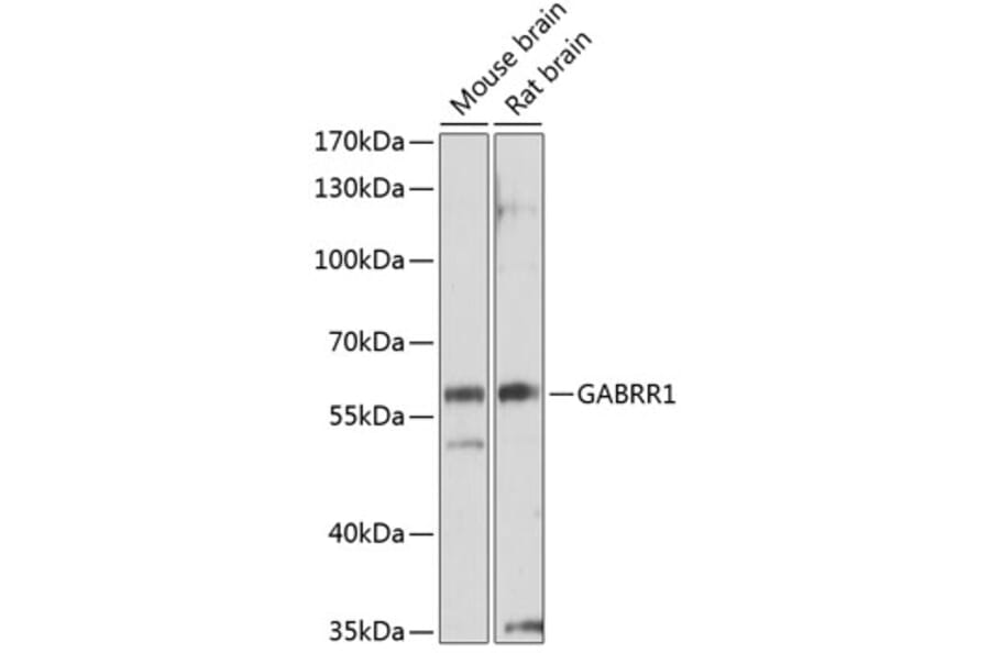 Western Blot - Anti-GABRR1 Antibody (A14261) - Antibodies.com