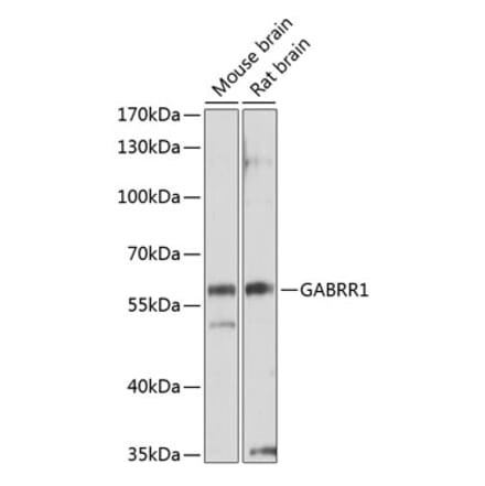 Western Blot - Anti-GABRR1 Antibody (A14261) - Antibodies.com