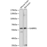 Western Blot - Anti-GABRR1 Antibody (A14261) - Antibodies.com