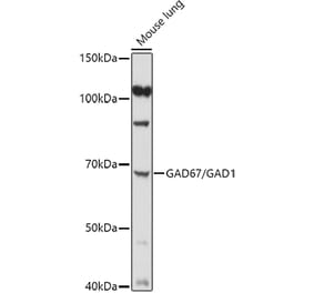 Western Blot - Anti-GAD67 Antibody (A14262) - Antibodies.com