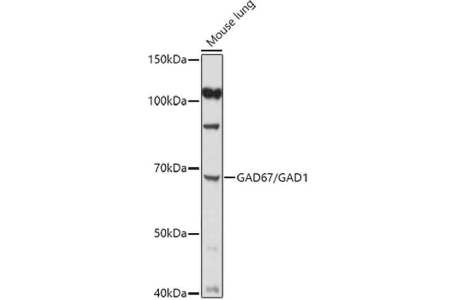 Western Blot - Anti-GAD67 Antibody (A14262) - Antibodies.com