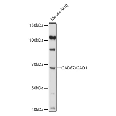 Western Blot - Anti-GAD67 Antibody (A14262) - Antibodies.com