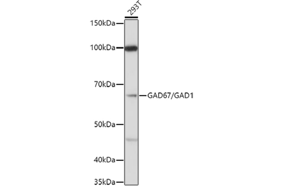 Western Blot - Anti-GAD67 Antibody (A14262) - Antibodies.com