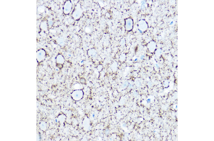 Immunohistochemistry - Anti-GAD67 Antibody (A14262) - Antibodies.com