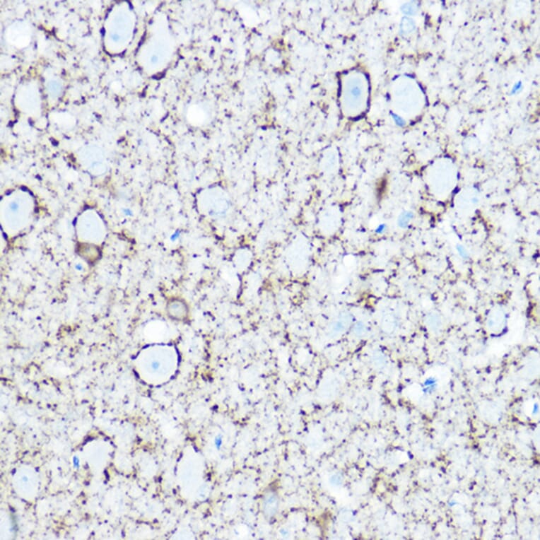 Immunohistochemistry - Anti-GAD67 Antibody (A14262) - Antibodies.com