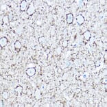 Immunohistochemistry - Anti-GAD67 Antibody (A14262) - Antibodies.com