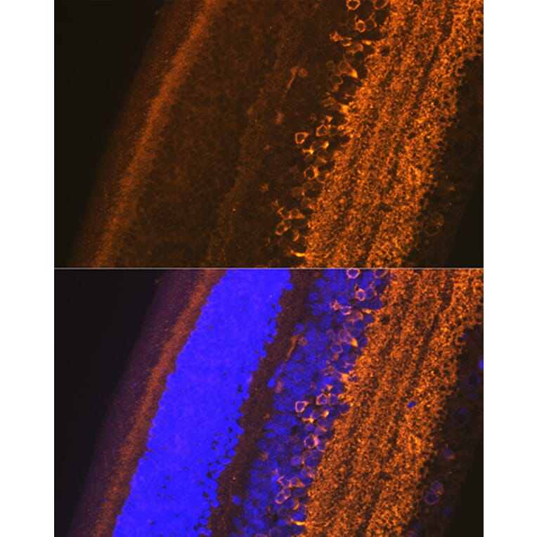Immunofluorescence - Anti-GAD67 Antibody (A14262) - Antibodies.com