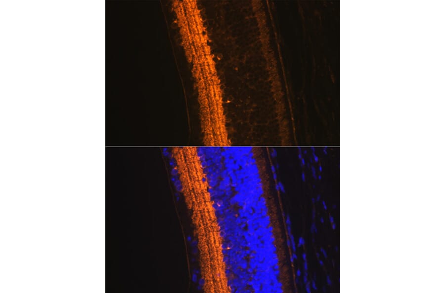 Immunofluorescence - Anti-GAD67 Antibody (A14262) - Antibodies.com