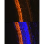Immunofluorescence - Anti-GAD67 Antibody (A14262) - Antibodies.com