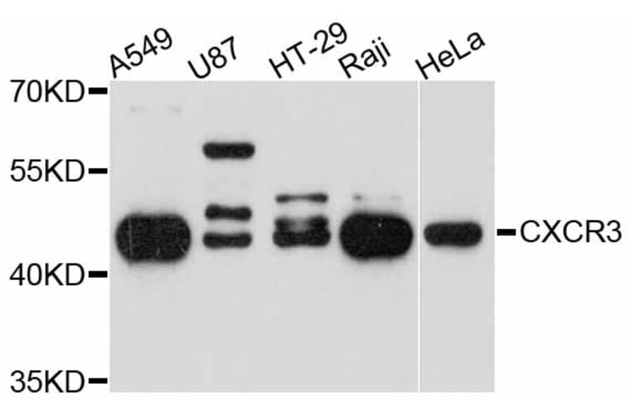 Western Blot - Anti-CXCR3 Antibody (A14263) - Antibodies.com