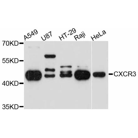 Western Blot - Anti-CXCR3 Antibody (A14263) - Antibodies.com