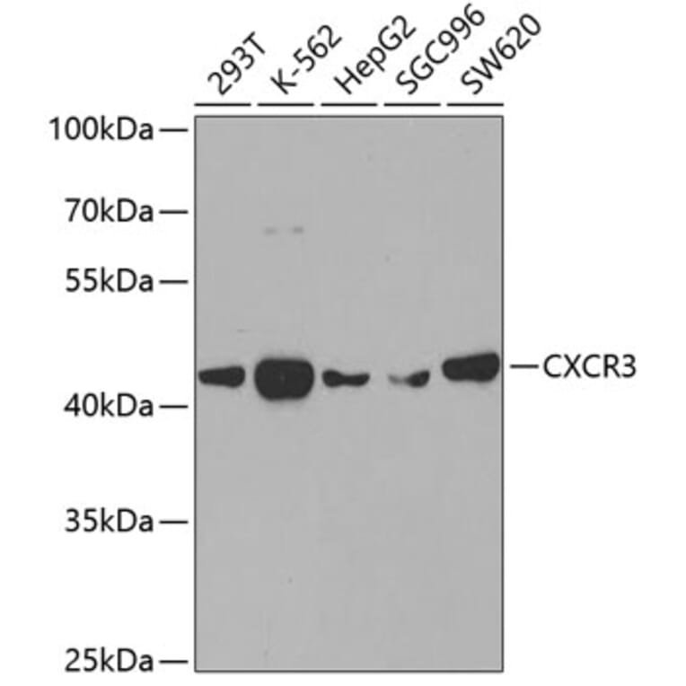 Western Blot - Anti-CXCR3 Antibody (A14263) - Antibodies.com