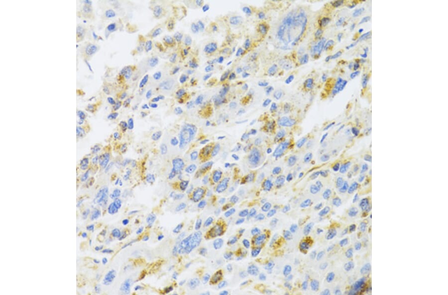 Immunohistochemistry - Anti-CXCR3 Antibody (A14263) - Antibodies.com