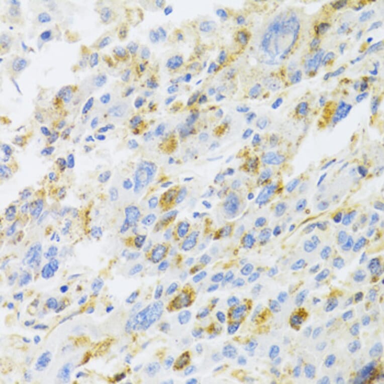 Immunohistochemistry - Anti-CXCR3 Antibody (A14263) - Antibodies.com