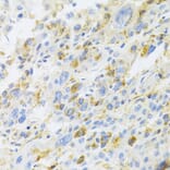 Immunohistochemistry - Anti-CXCR3 Antibody (A14263) - Antibodies.com