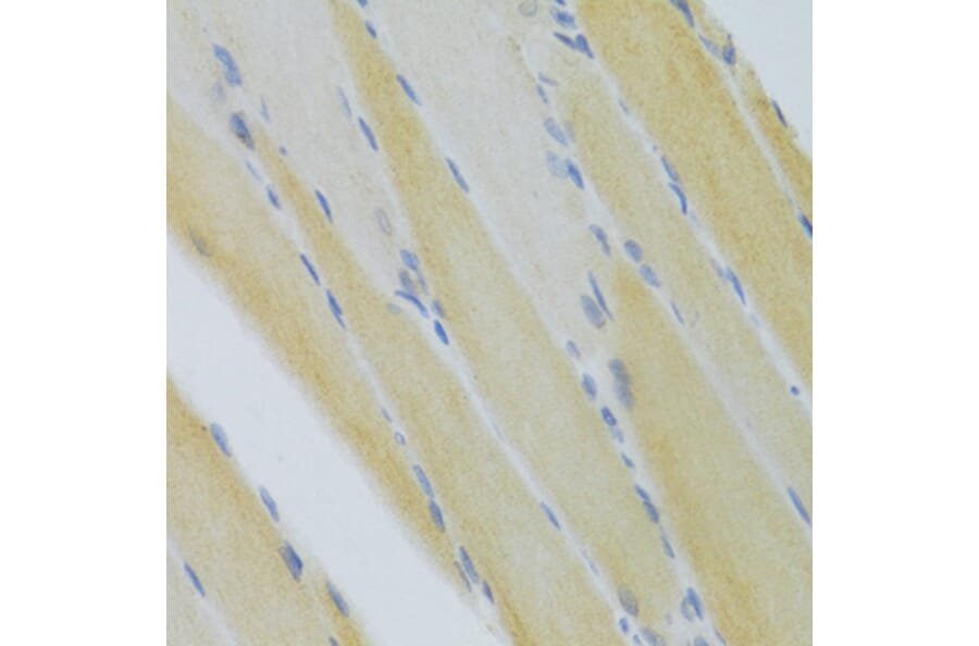 Immunohistochemistry - Anti-CXCR3 Antibody (A14263) - Antibodies.com
