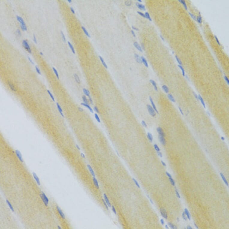 Immunohistochemistry - Anti-CXCR3 Antibody (A14263) - Antibodies.com