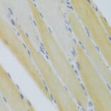 Immunohistochemistry - Anti-CXCR3 Antibody (A14263) - Antibodies.com