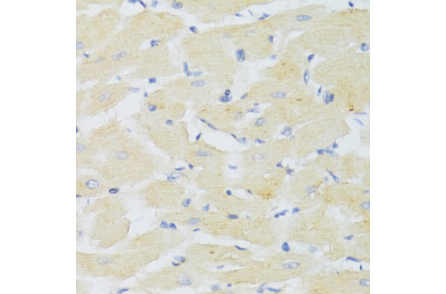 Immunohistochemistry - Anti-CXCR3 Antibody (A14263) - Antibodies.com