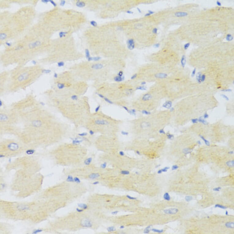 Immunohistochemistry - Anti-CXCR3 Antibody (A14263) - Antibodies.com
