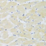 Immunohistochemistry - Anti-CXCR3 Antibody (A14263) - Antibodies.com